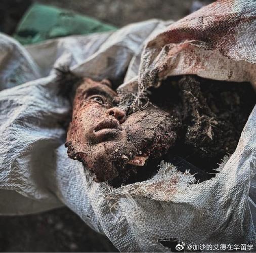 巴以冲突致37名巴勒斯坦人受伤